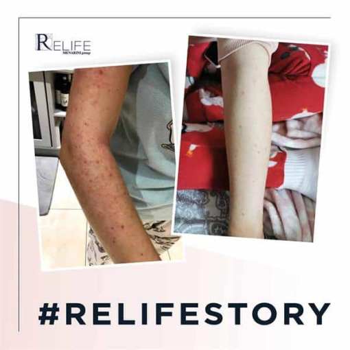 Relife - Relizema Cream 40ml - Image 2