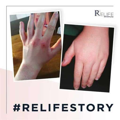 Relife - Relizema Cream 40ml - Image 3